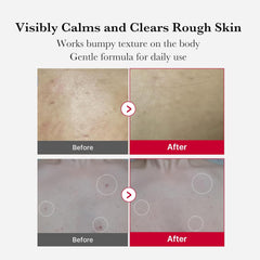 Medicube | Red Acne Body Peeling Shot 110g