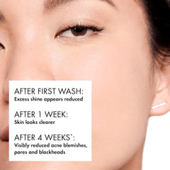 Vichy | Normaderm PhytoAction Salicylic Acid Gel Cleanser 400ml