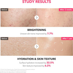 APRILSKIN - TXA Niacinamide 99 Milky Toner 150ml