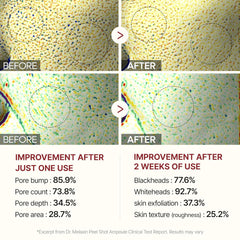 Dr.Melaxin | Peel Shot Exfoliant White Rice Ampoule 80ml