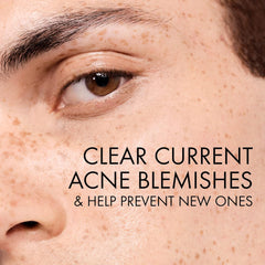 Vichy | Normaderm PhytoAction Salicylic Acid Gel Cleanser 400ml