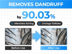 Seapuri | Scalpy Hair Serum 20ml