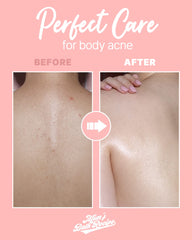 Mom’s Bath Recipe Body Peeling Pad 1*8pcs