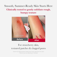 Medicube | Red Acne Body Peeling Shot 110g