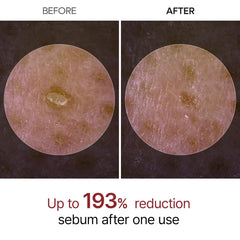Dr.Melaxin | Peel Shot Exfoliant Black Rice Ampoule 80ml