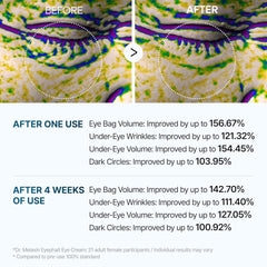 Dr.Melaxin | Eyephalt Eyebag Cream 10ml